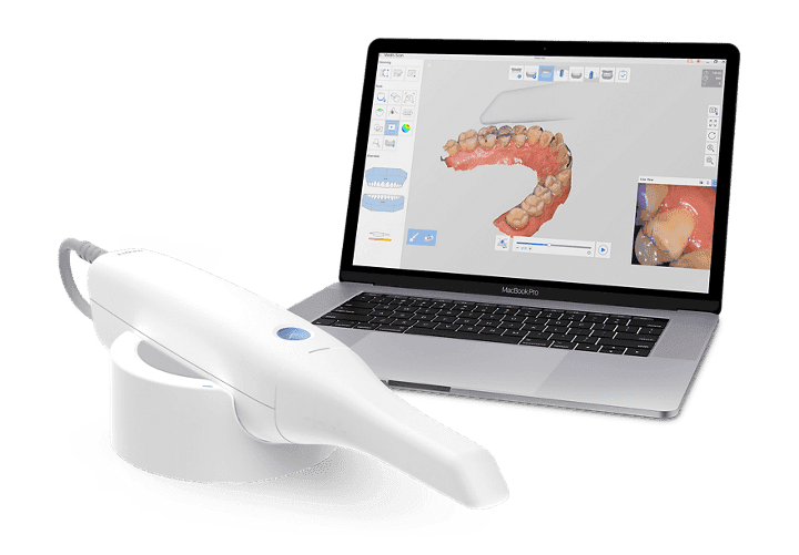 Dental Scanning Solutions digital workflow